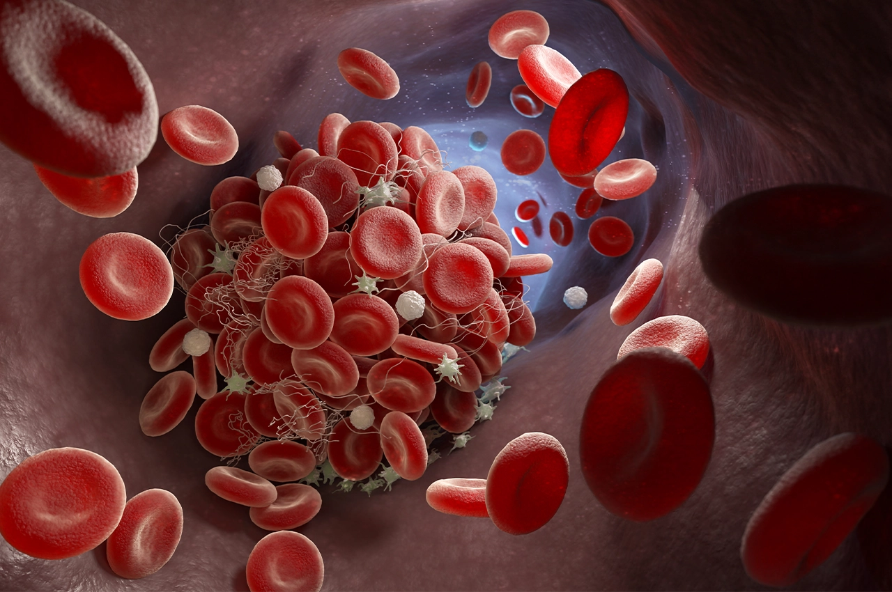 Read more about the article Damar Tıkanıklığı Nedir? Ne İyi Gelir?